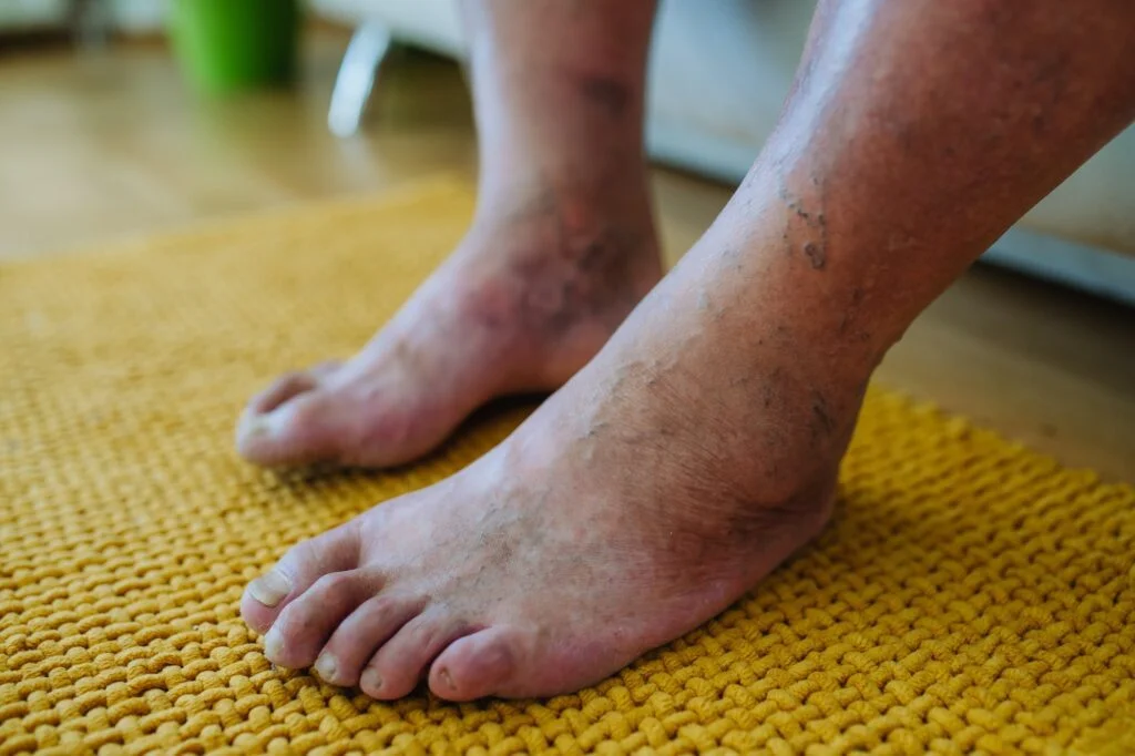 Expert Podiatrist Tips for Effective Diabetic Foot Care